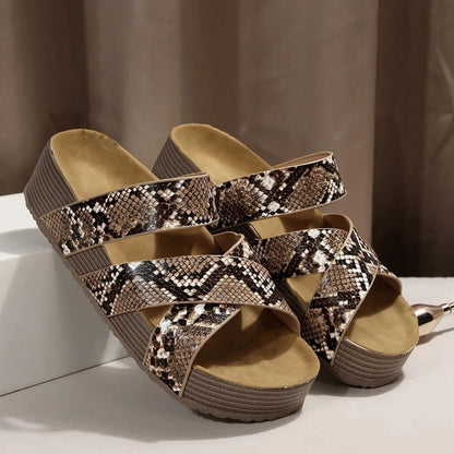 Abigail™ – Orthopedic Leather Strap Summer Sandals