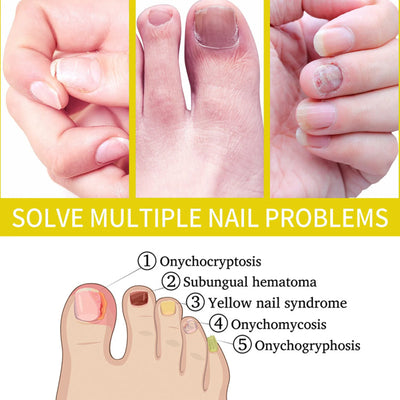 Nail Oil For Growth And Strength Rejuvenation